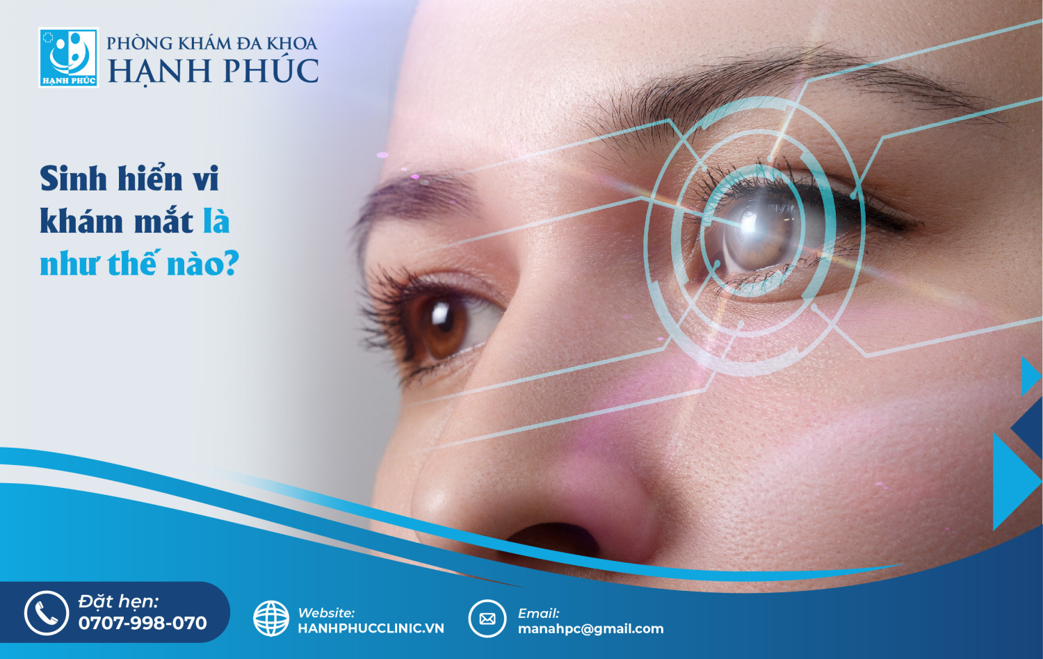 Sinh hiển vi khám mắt là như thế nào?